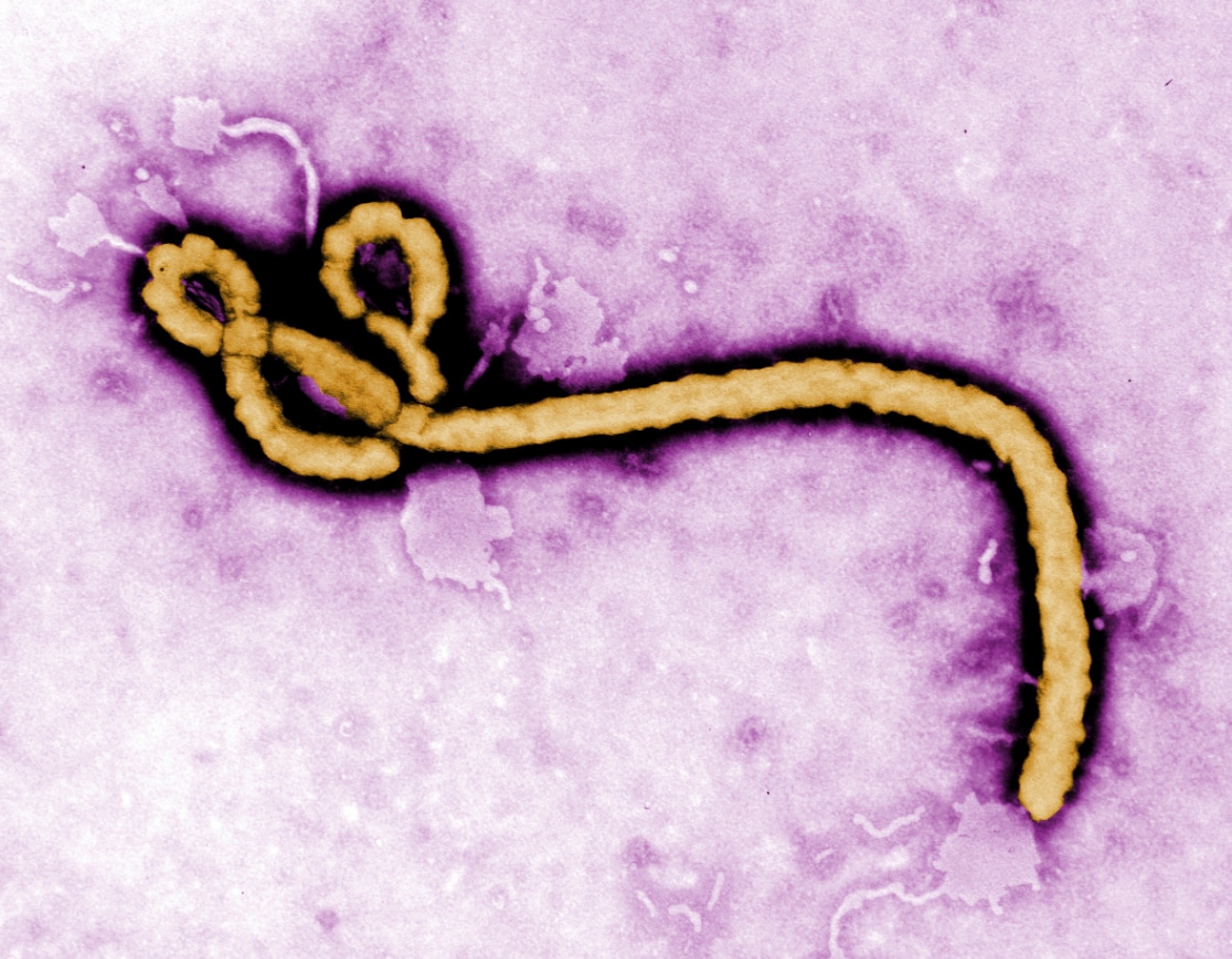 The Ebola virus under a microscope.