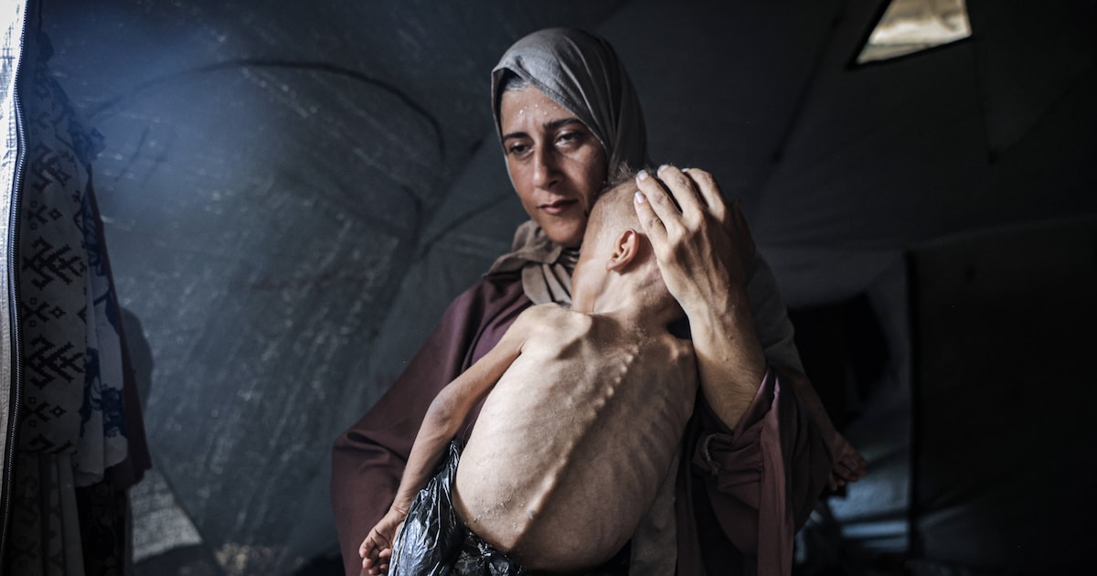 Fotos von abgemagertem Kind sorgen für Kontroverse in Gaza-Berichterstattung