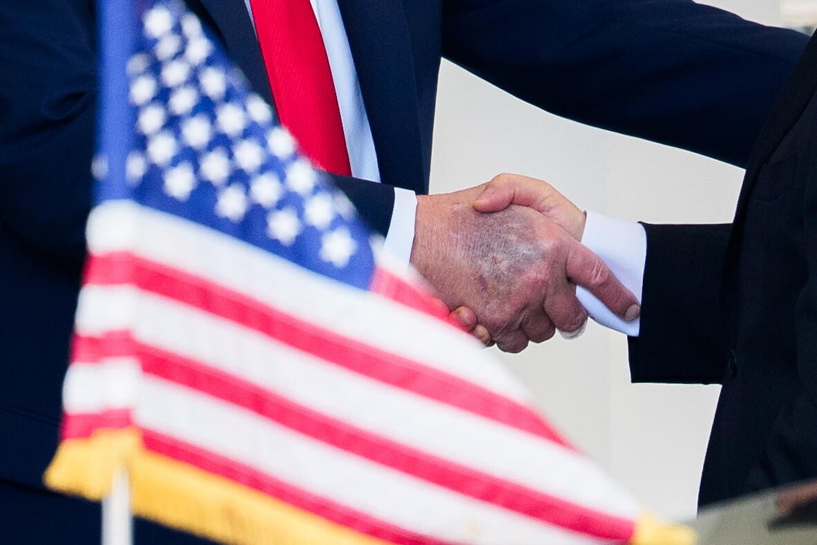 Синяки на руке Трампа