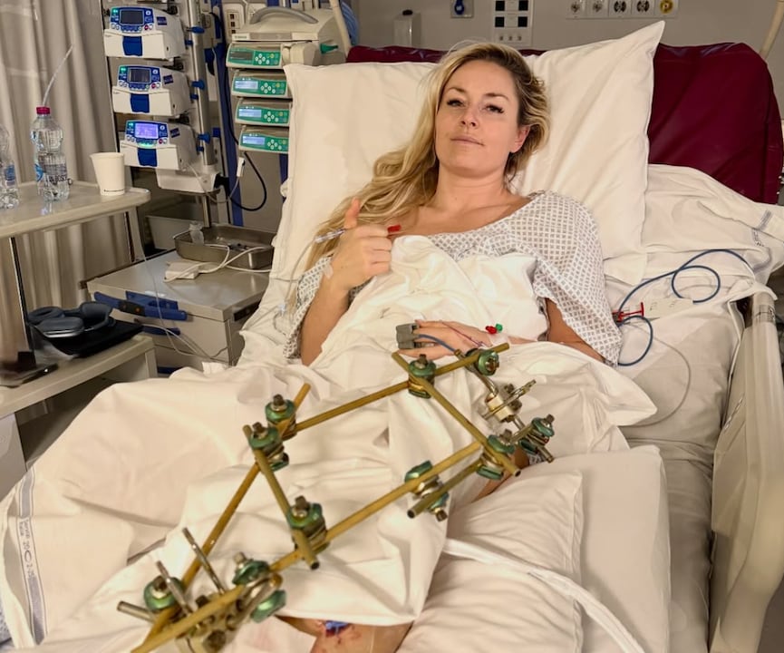 Lindsey Vonn was allowed to return home after her serious injury at the Olympics