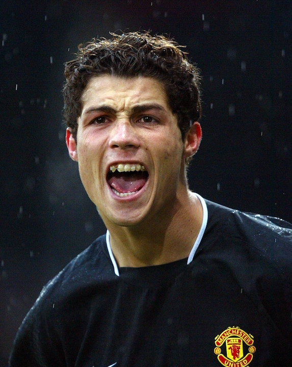 Oggi Cristiano Ronaldo ha un sorriso perfetto, degno di Hollywood. Nel 2005, la stella del calcio portava ancora l'apparecchio.