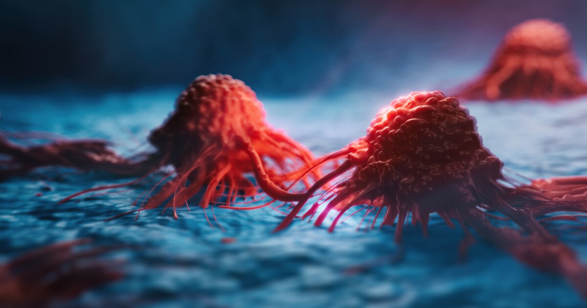 Reduce your cancer risk: What you should cut from your diet